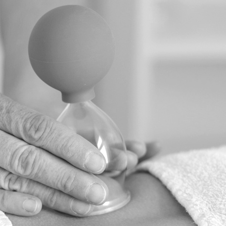 Das Schröpfen - Alte Kunst neu entdeckt